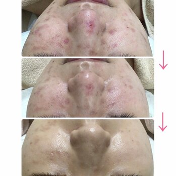 お肌は必ず変わります。