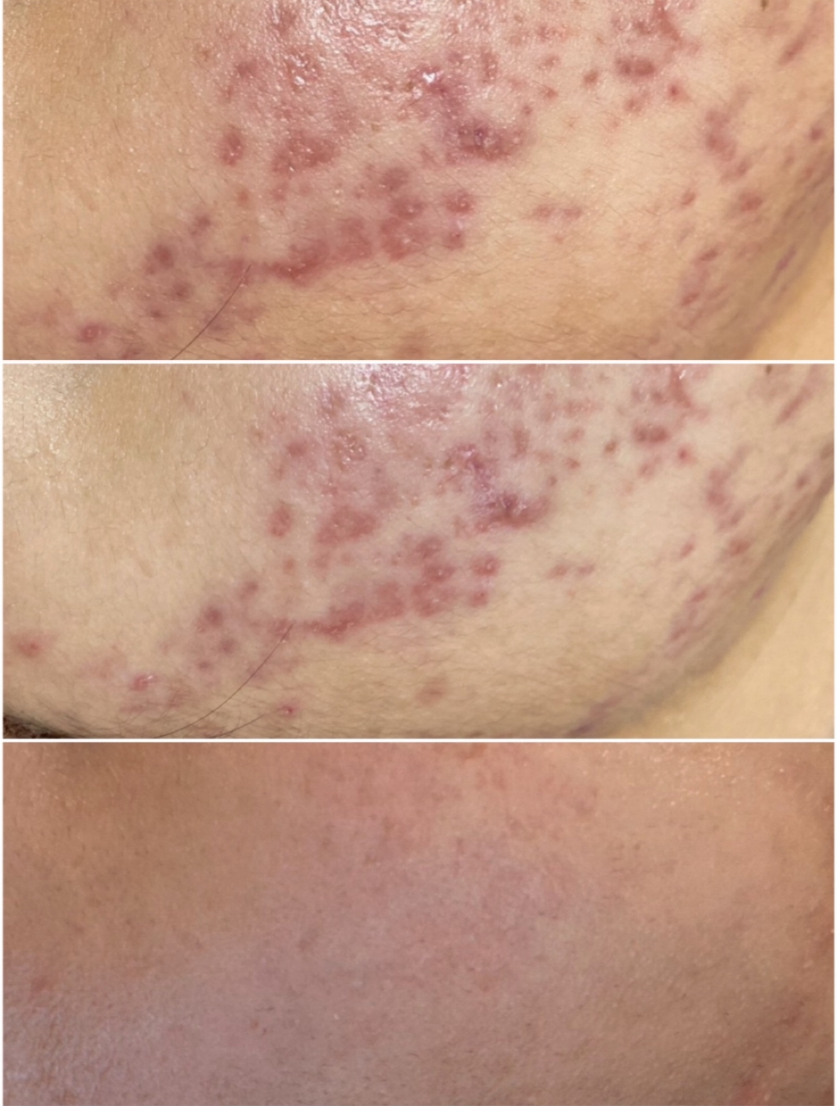 今だけしゃなく、これからの肌